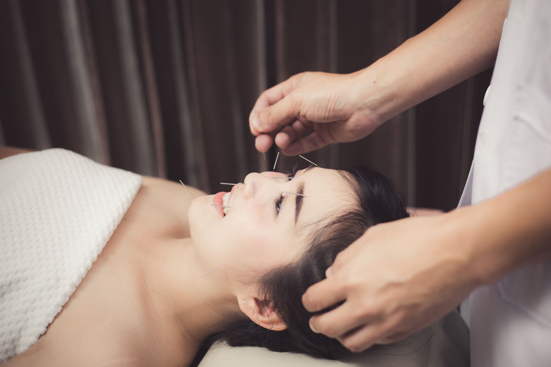 Woman in an acupuncture therapy at the health spa